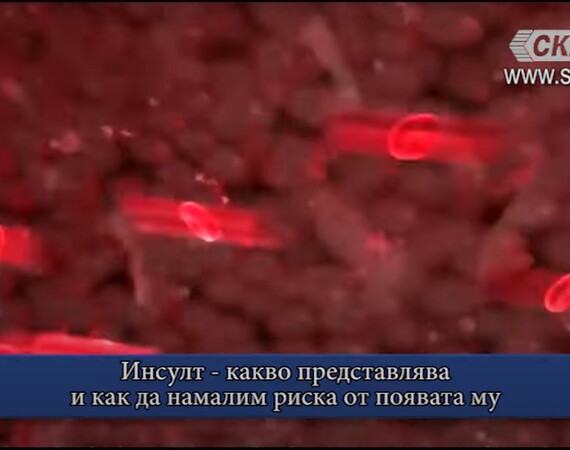 Д-р Анъл Хюсменов, невролог в МЦ "Лозенец"  в студиото на телевизия СКАТ