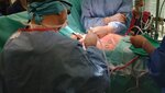 В УМБАЛ „Лозенец“ бе успешно приложен иновативния метод MICLAT S за смяна на аортна клапа
